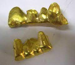 Vente d'or dentaire , vieil or et argent sur Toulon et Marseille